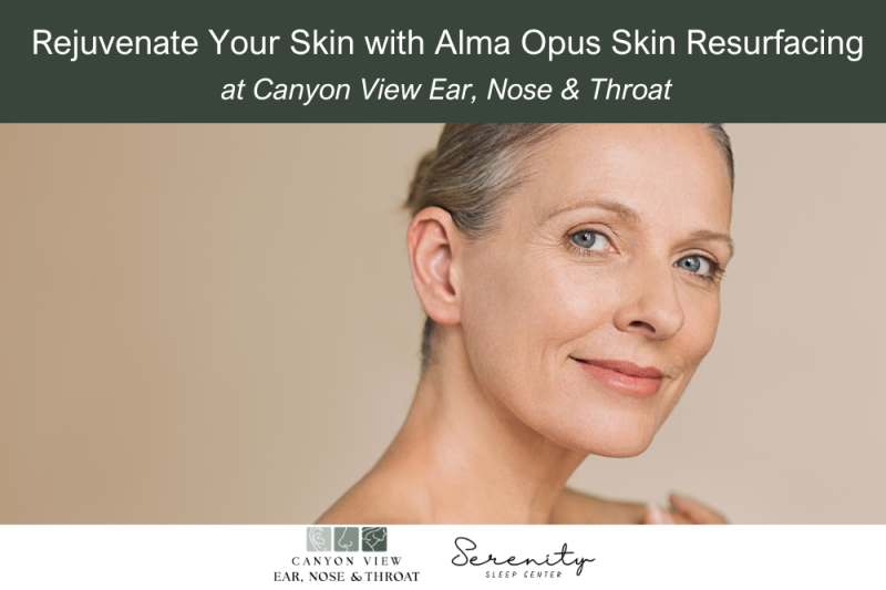 Rejuvenate Your Skin with Alma Opus Skin Resurfacing at Canyon View Ear, Nose & Throat