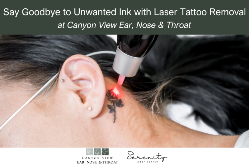 Say Goodbye to Unwanted Ink with Laser Tattoo Removal at Canyon View Ear, Nose & Throat