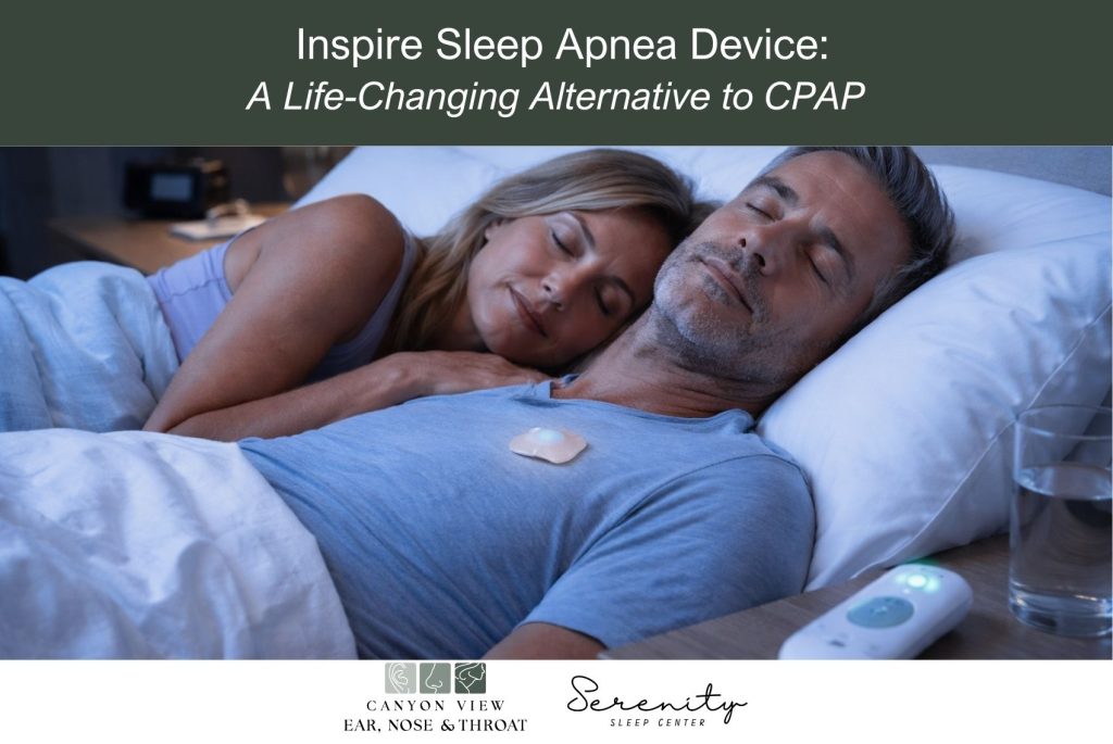 Inspire Sleep Apnea Device A Life-Changing Alternative to CPAP