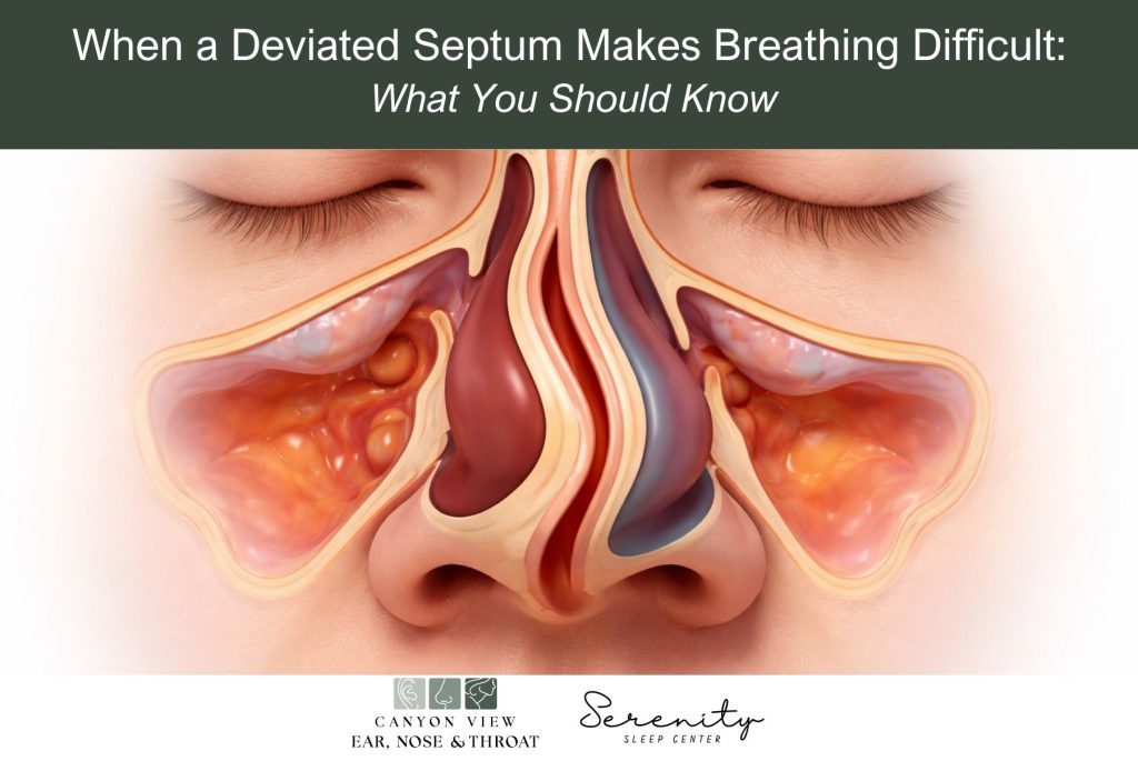 When a Deviated Septum Makes Breathing Difficult What You Should Know
